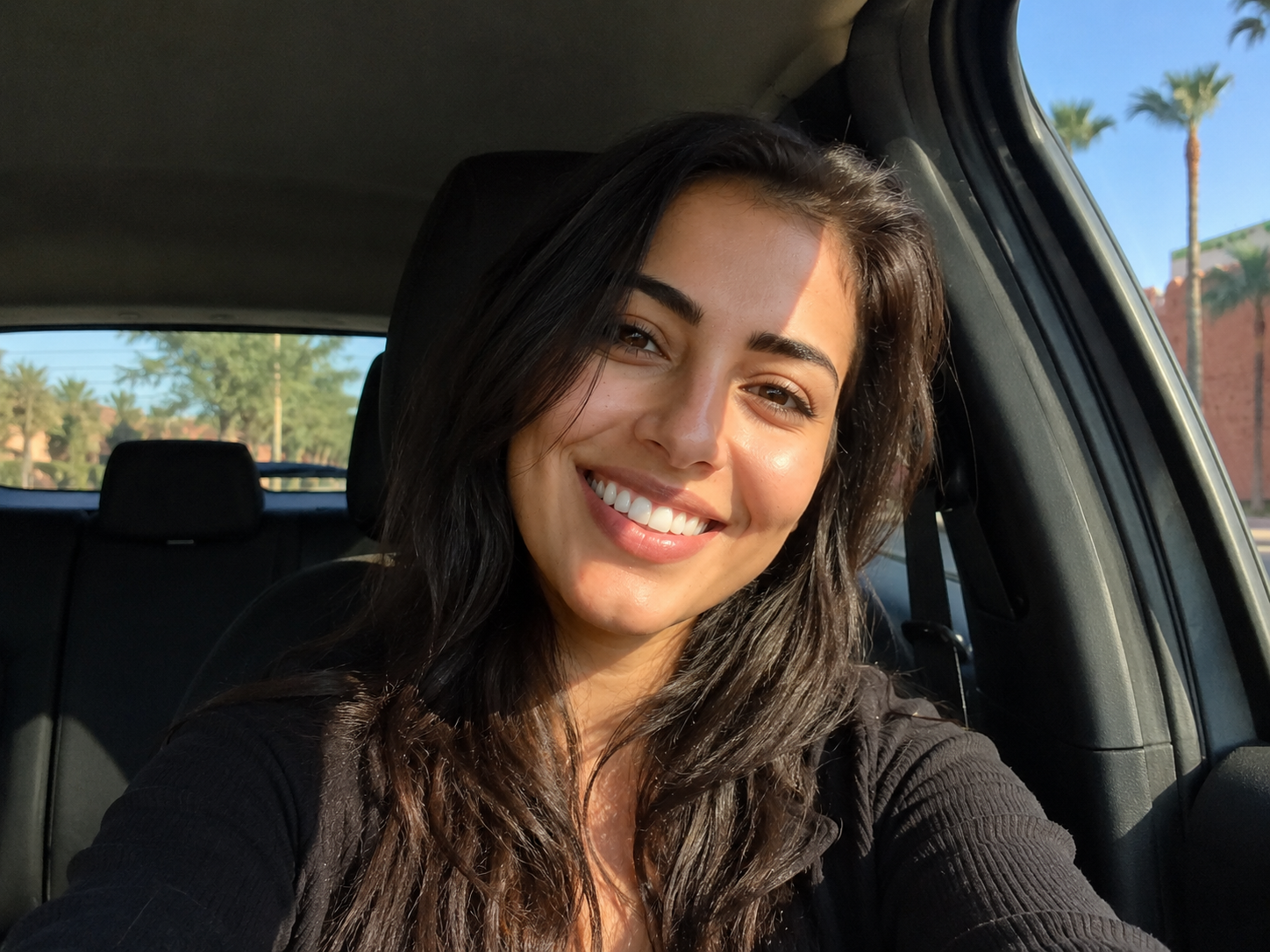 Réalisation harmonie du sourire